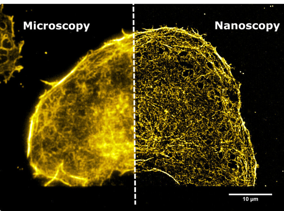 Mikroskopiske bilde av en levercelle. Vanlig mikroskopbilde til venstre, nanoskopi til høyre.