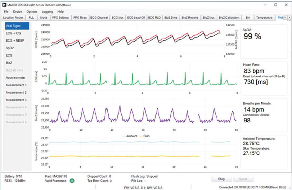 Figur 4: Utdatagrafer fra Analog Devices/Maxim Integrated vitale signaler utviklingsplattform.